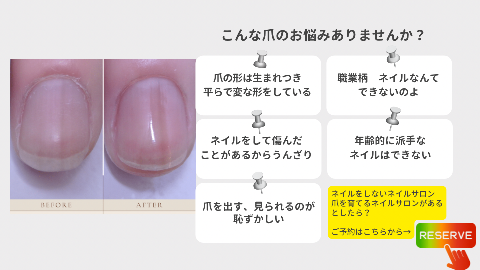 “爪の形は3ヶ月で自信に変えられる”